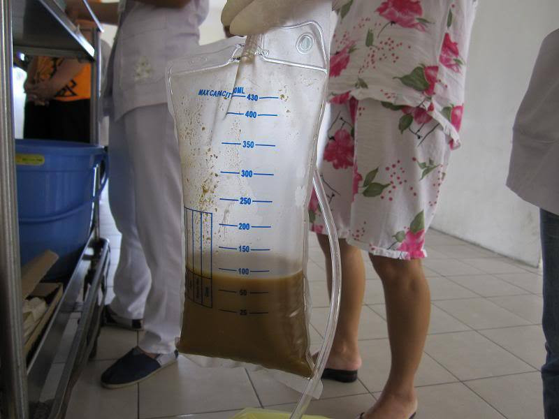 Cần biết đầy đủ kỹ thuật đặt sonde dạ dày