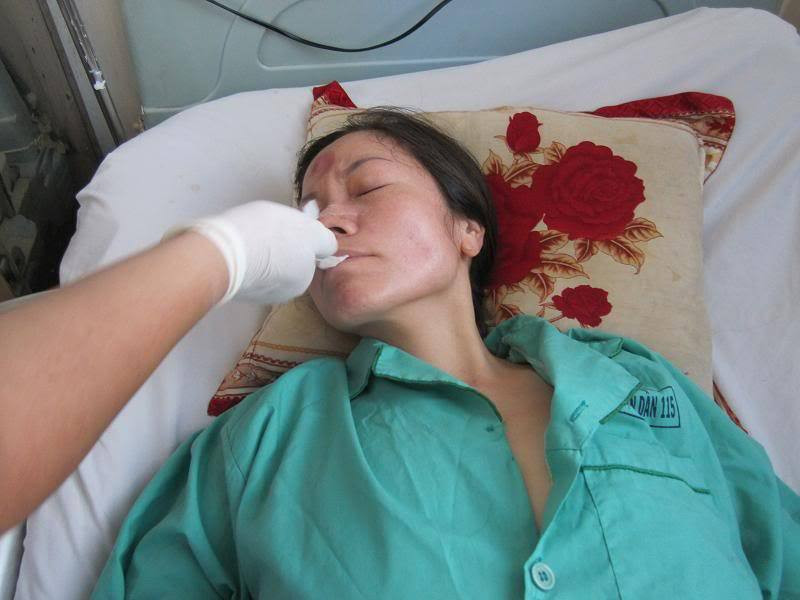 Kỹ thuật đặt sonde dạ dày là gì?